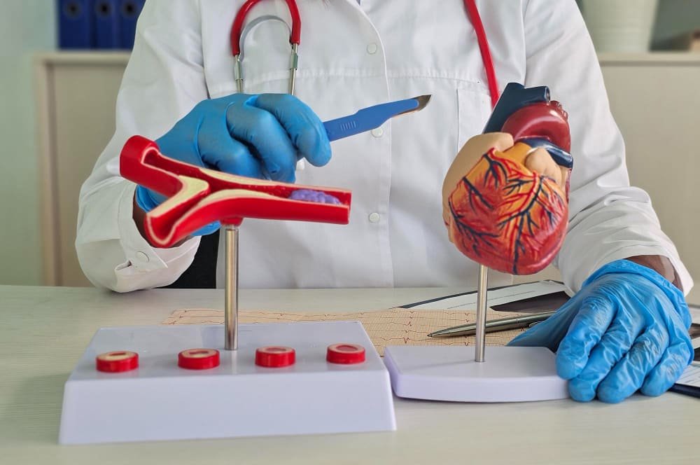 Cateterismo cardíaco y angioplastia coronaria percutánea en Nuevo León: diagnóstico y tratamiento para enfermedades de las arterias coronarias